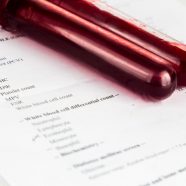 Jak często należy robić badanie krwi?